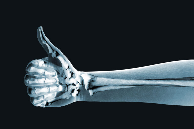 Mobility, Bones & Joints